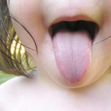 Banalizando – Banalizando