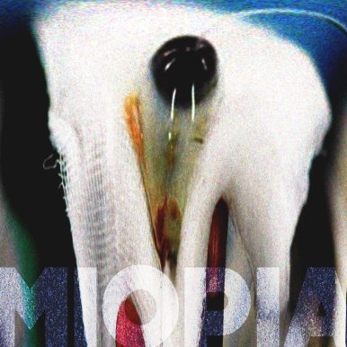 bbarrenha – MIOPIA