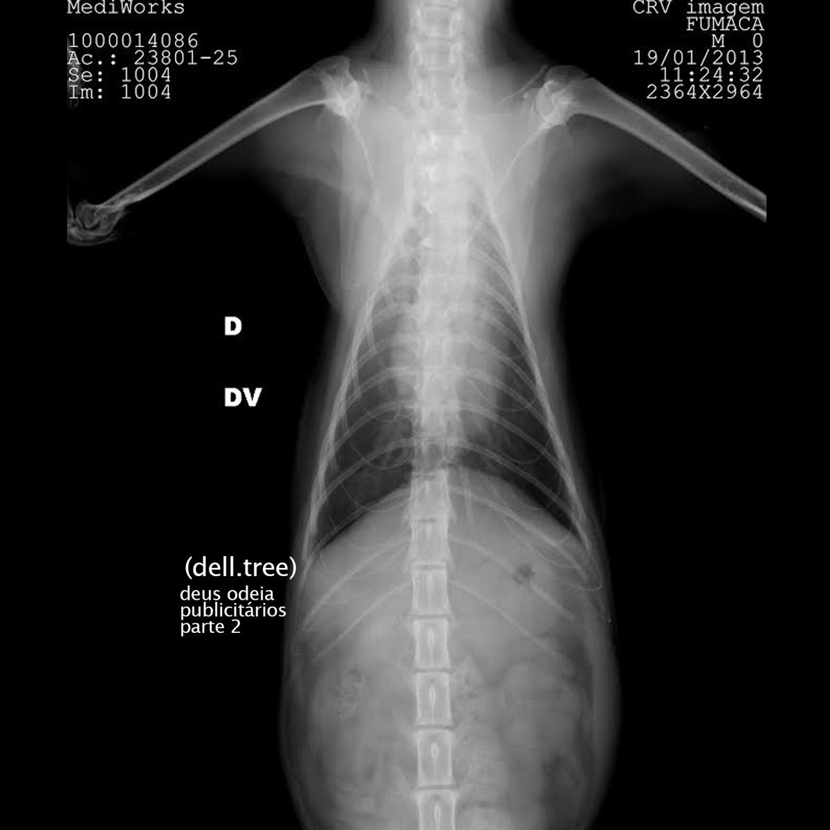 (dell.tree) – Deus Odeia PublicitĂĄrios ptâ.â2